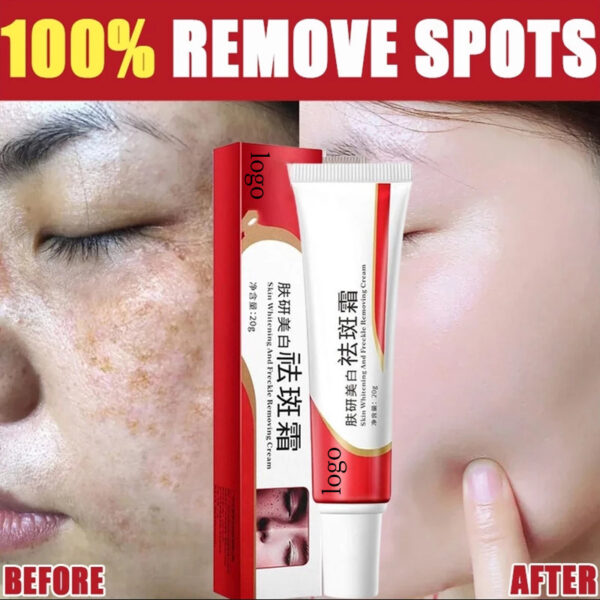 Freckle Cream Whitening Skin Universal